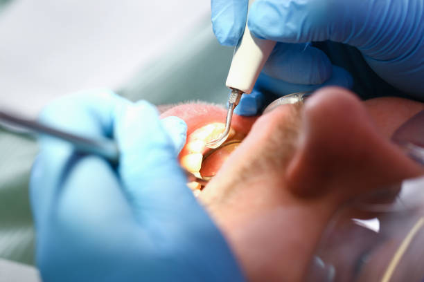 Best Broken or Cracked Tooth Emergency Dentist in Topton, PA
